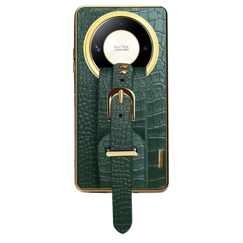 Telefontok Honor X9b / Magic 6 Lite Karkötő-támogatás