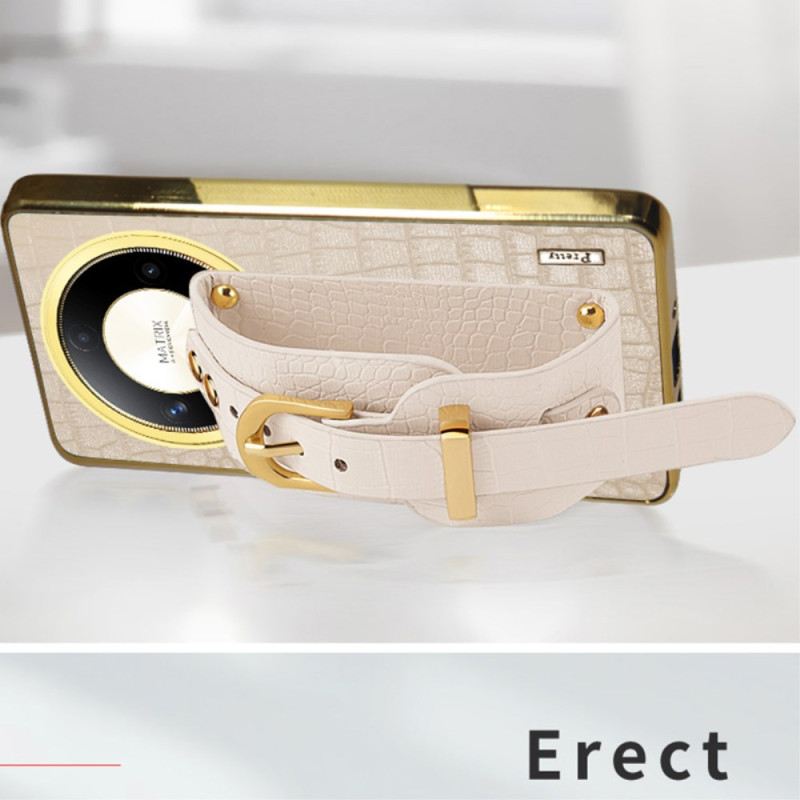 Telefontok Honor X9b / Magic 6 Lite Karkötő-támogatás