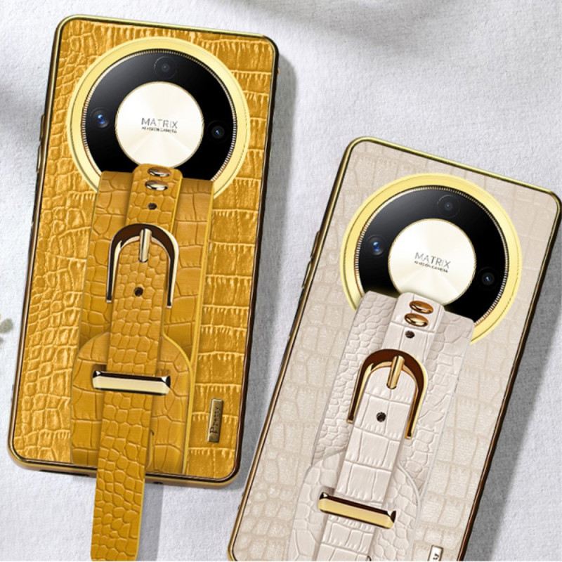 Telefontok Honor X9b / Magic 6 Lite Karkötő-támogatás